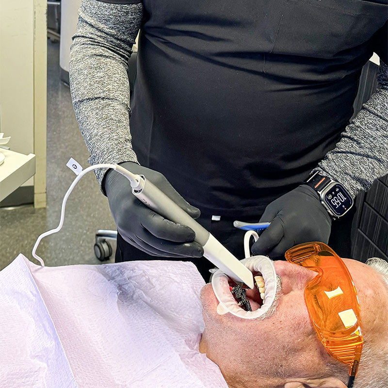 Shining 3D Aoralscan Elite